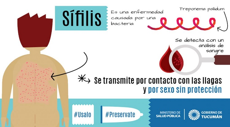 sifilis1